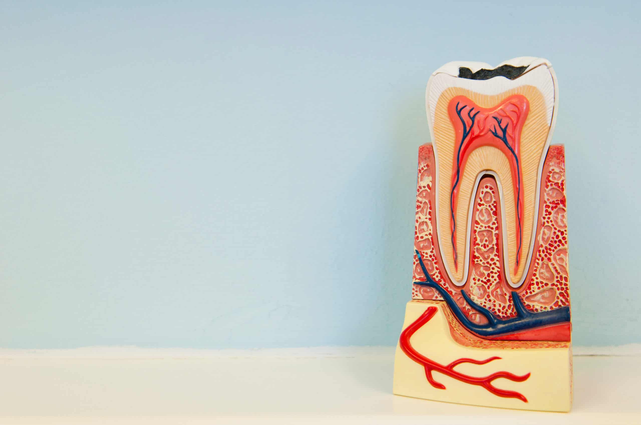 How is a root canal performed? Root Canal Treatment in Toronto York