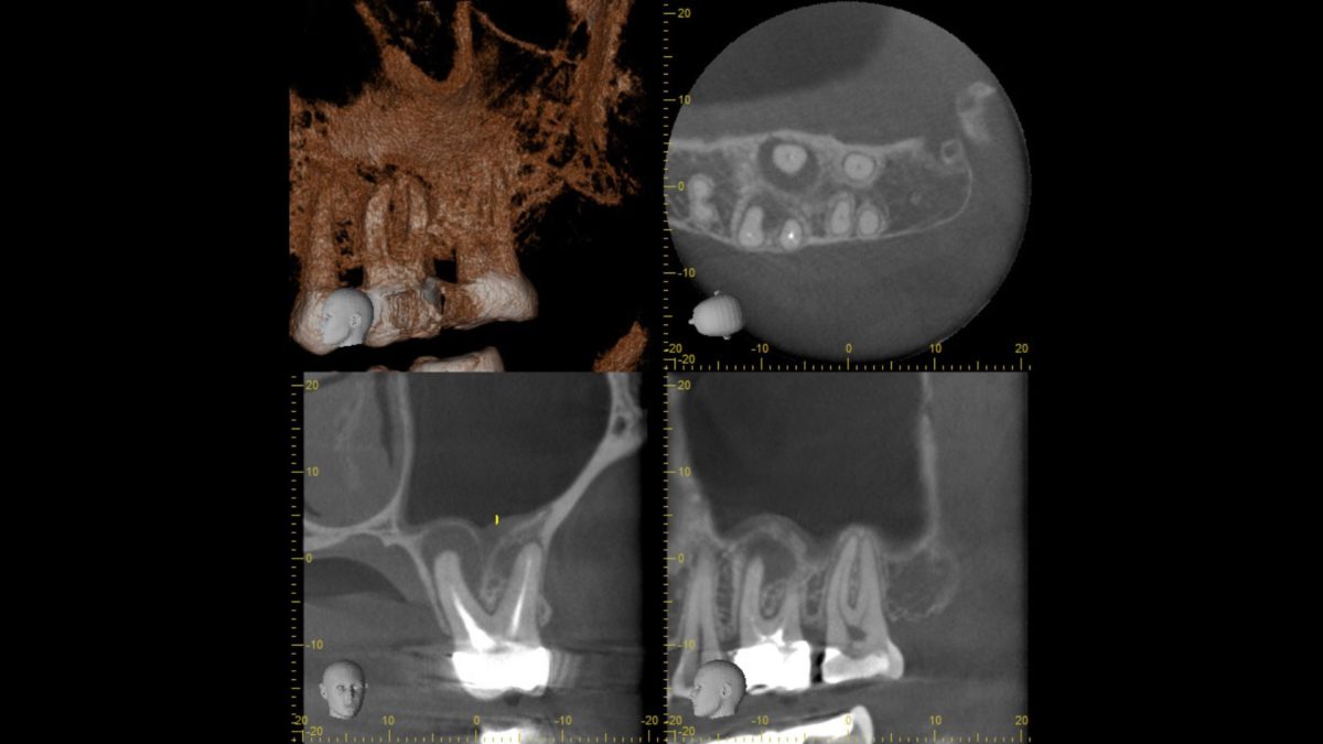 example of cbct scan